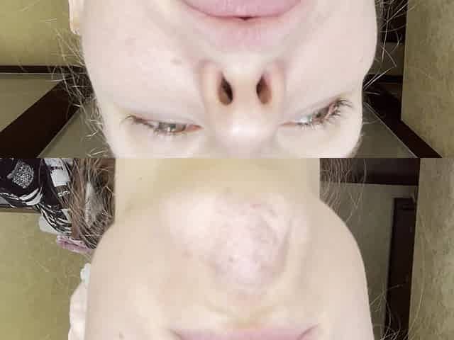 Extreme Phlegm Build-up & Release up-close Nasal & Throat Action