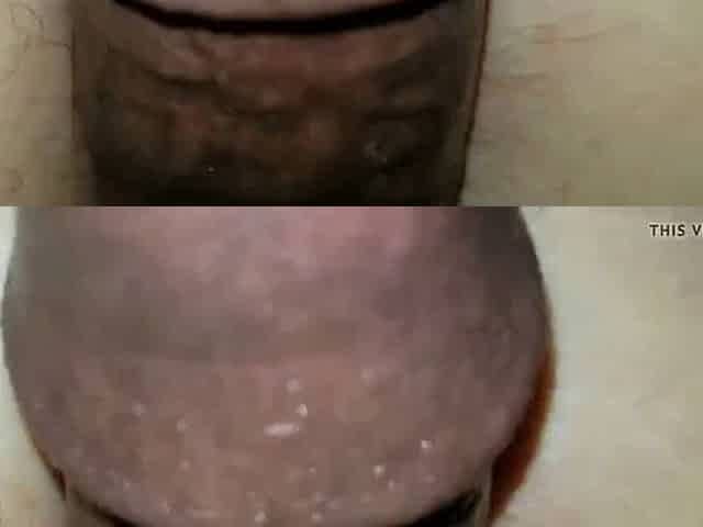 Close up anal