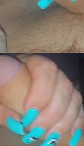 I'm Comforting My Stepmother with a Bruise on Her Butt