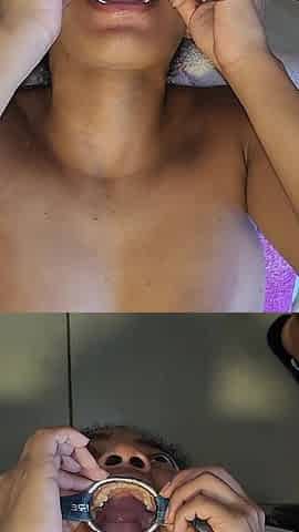 Throat Fuck with Open Mouth Gag and Spit Cum in Mouth