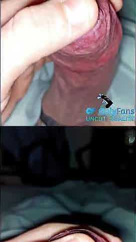 cum play with phimosis constricted foreskin