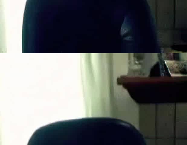 Hairy Webcam Girl in Wheelchair Shows Off