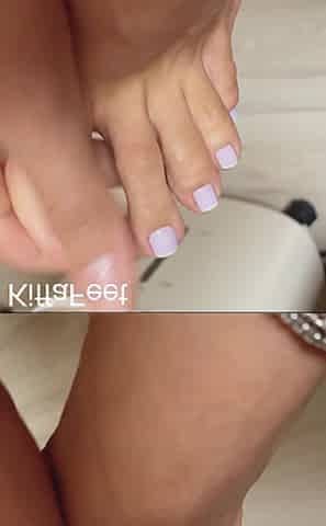 My Second Weird Toe