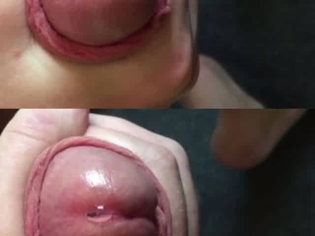 Virgin tries sounding with a 12mm urethral sound