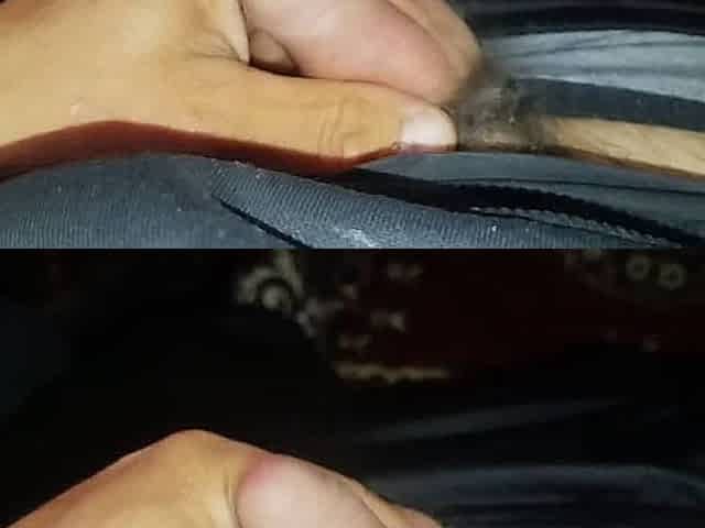 Penis
