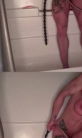 Prolapse Series Part Five