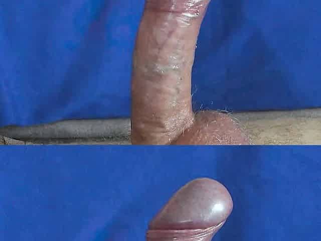 Insane Prostate Milking. Spunk fountain from prostate massage.