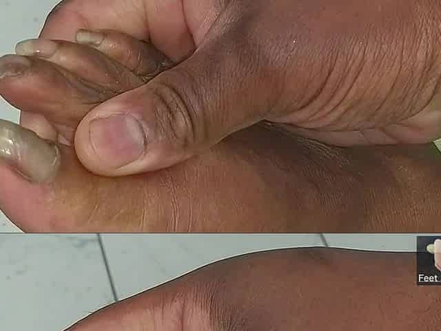 Nurse Jasmine Doe's Afterwork Hot Stinky Feet N Nude Long Toenails