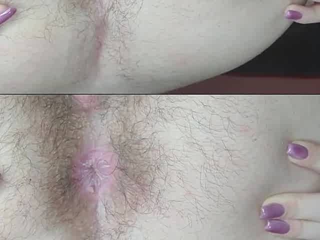 Asshole Hairy Extreme Closeup