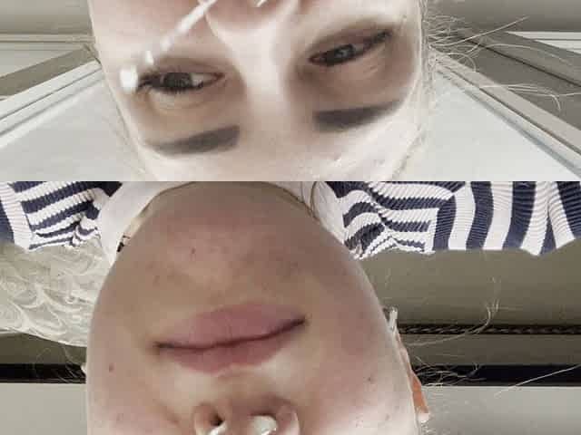 Thick Snot and Mucus Release From Nose