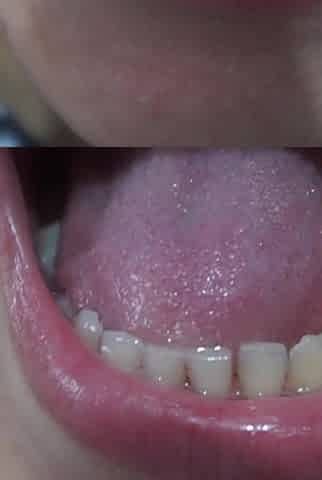 My Indian Stepsister Show Me Inside Her Mouth Her Tongue and Teeth