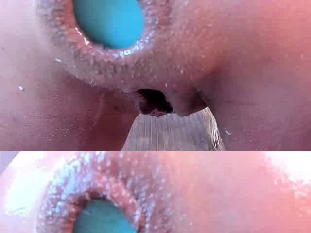 StripCamFun Amateur Webcam Anal Amateur Anal Porn Video