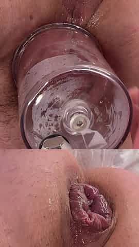 Extreme Anal and Pussy Pumping Fall 2025