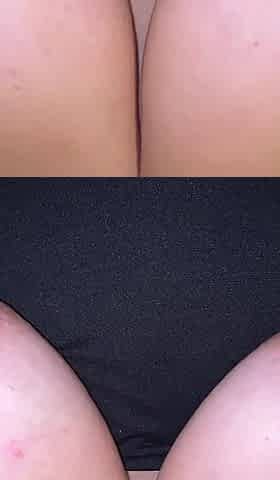 Nipple Training