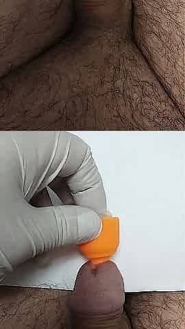 yellow in the urethra