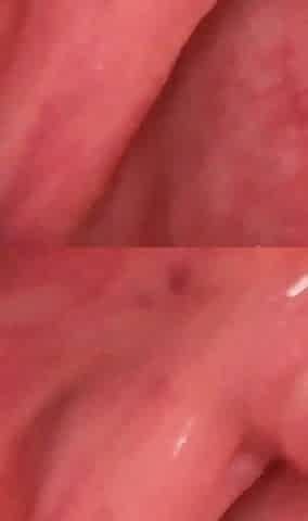 Mouth Fetish Uvula Close I Gag on a Hard BBC