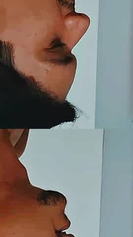 Eating the Blonde Tail