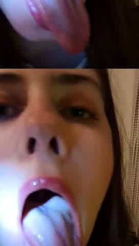 SLIT CLINIC - Oral Examination {Lighting The Tongue}