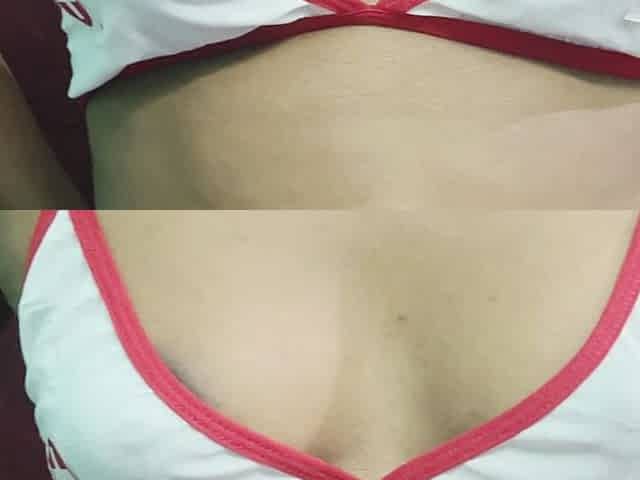 Tamil Nurse Live Checkup