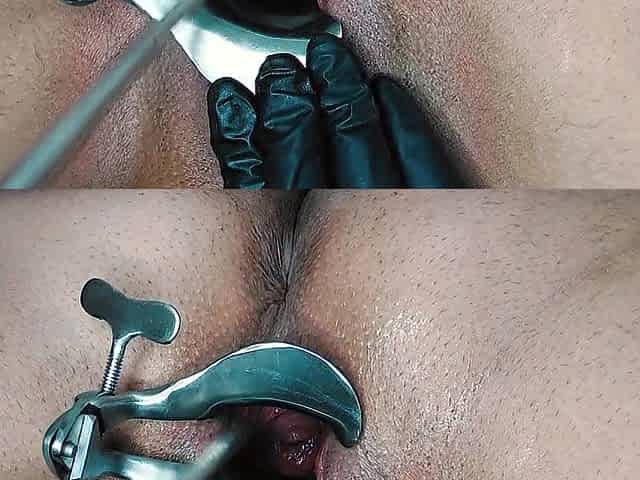 [MOVIE SCENE] Unfathomable FTM Cervix Sounding